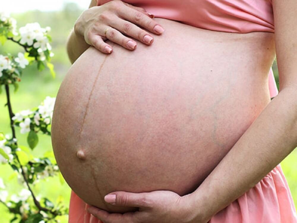 6 vấn đề về da thường gặp khi mang thai mẹ bầu cần chú ý