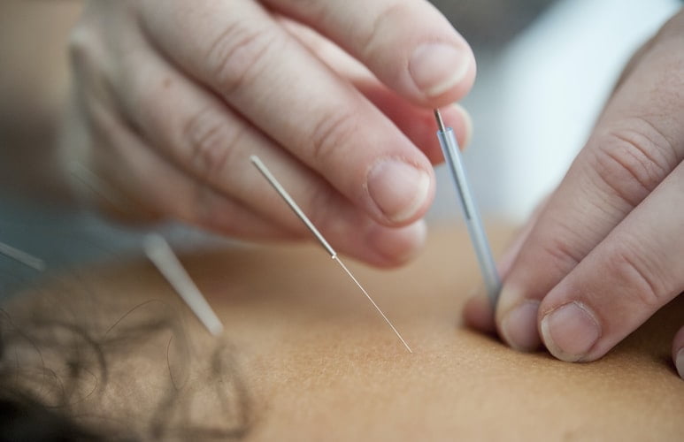 The Reason Why the Summer Is the Perfect Time to Begin Getting Acupuncture – Photo by Katherine Hanlon