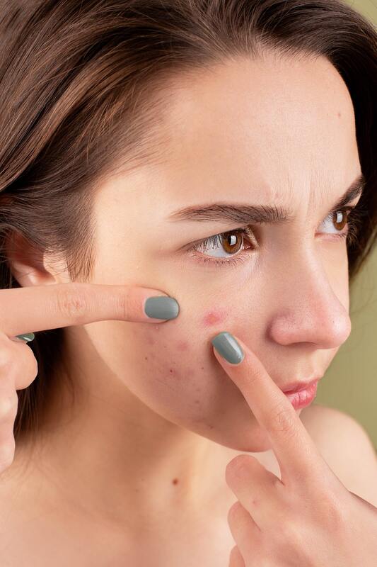 Acupuncture on face