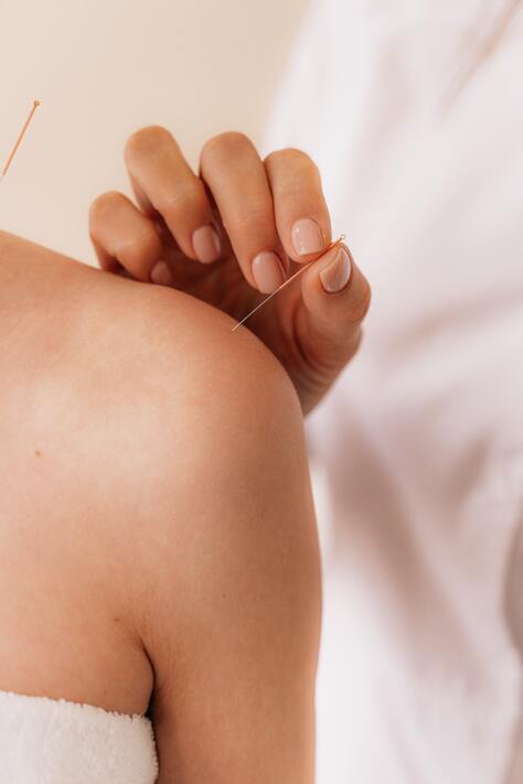 acupuncture when pregnant