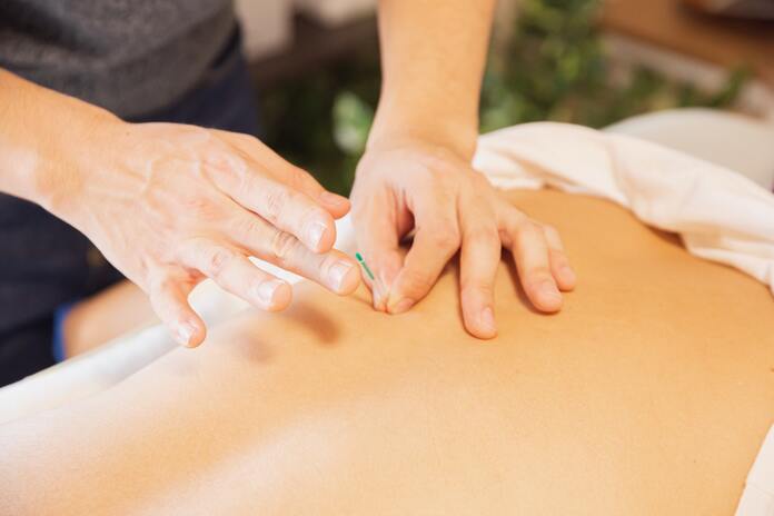 acupuncture when pregnant