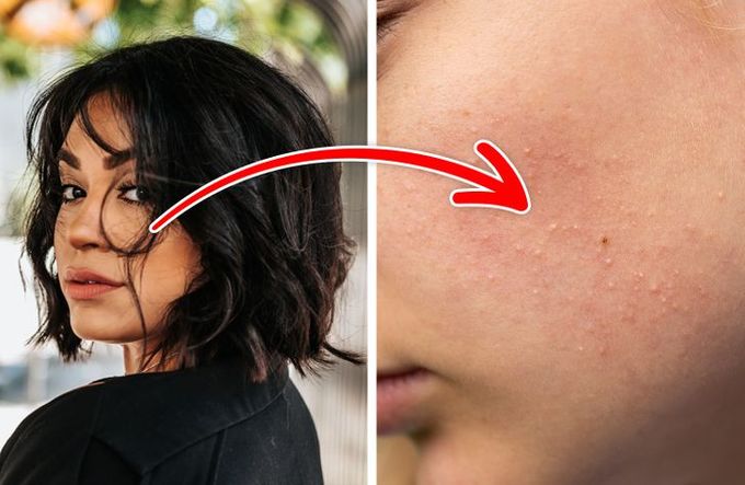 pores 2