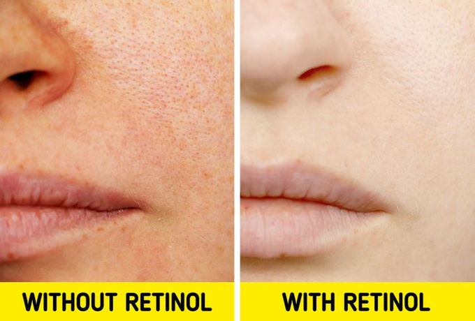 retinol