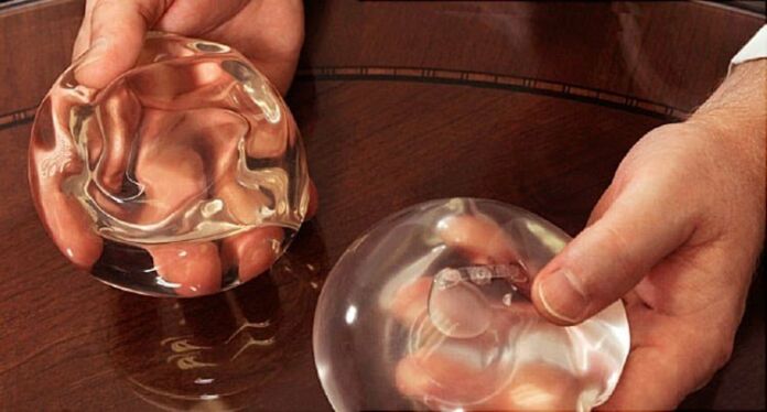 Top List of Plastic Surgeons with Breast Implants