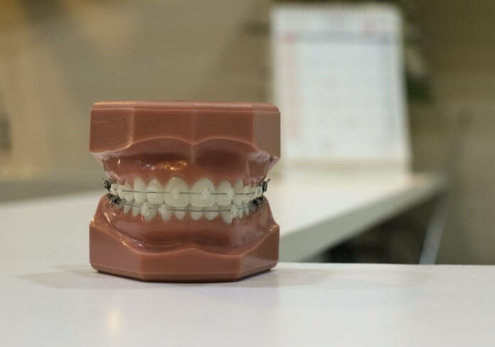 Orthodontic – Photo by Yingpis Kalayom