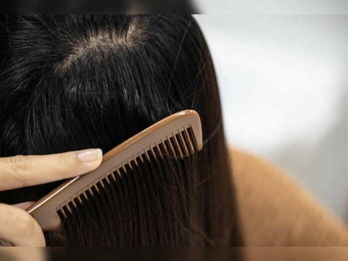 Hair Care: Do-it-yourself oily scalp treatments - Element5 Digital