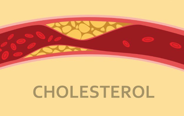 Why cholesterol is high in a healthy person?