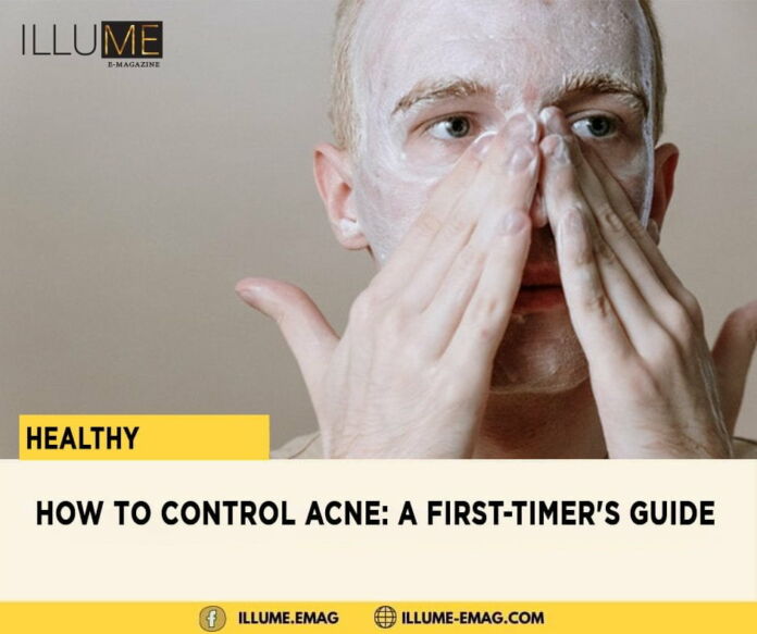 How To Control Acne: A First-Timer's Guide