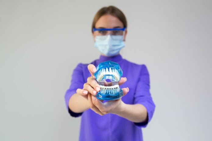 Teeth-Bleaching Service