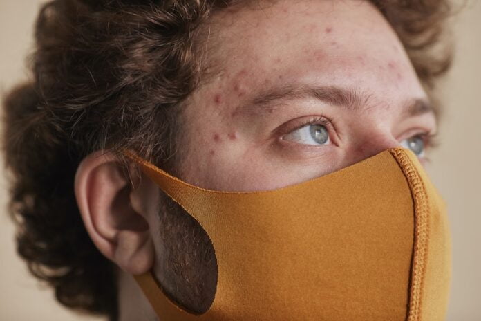 clear acne fast