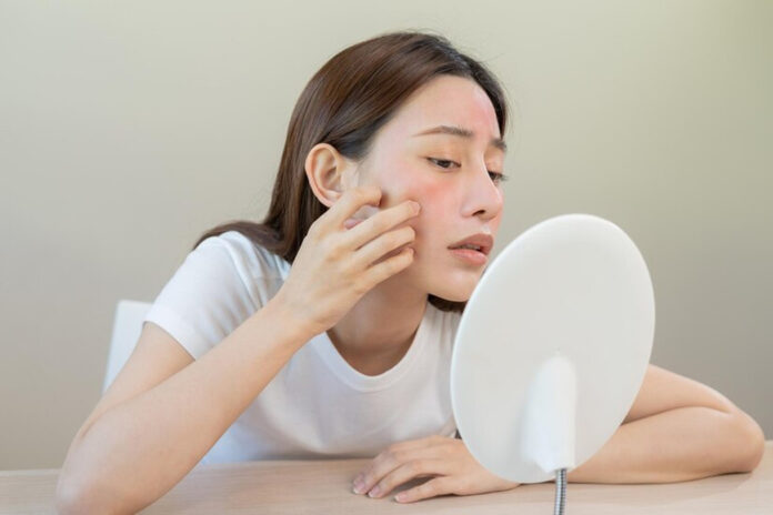 dịu da