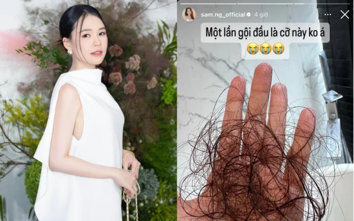 tóc rụng