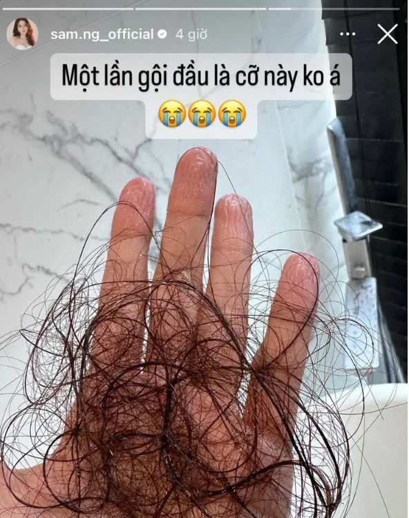 tóc rụng