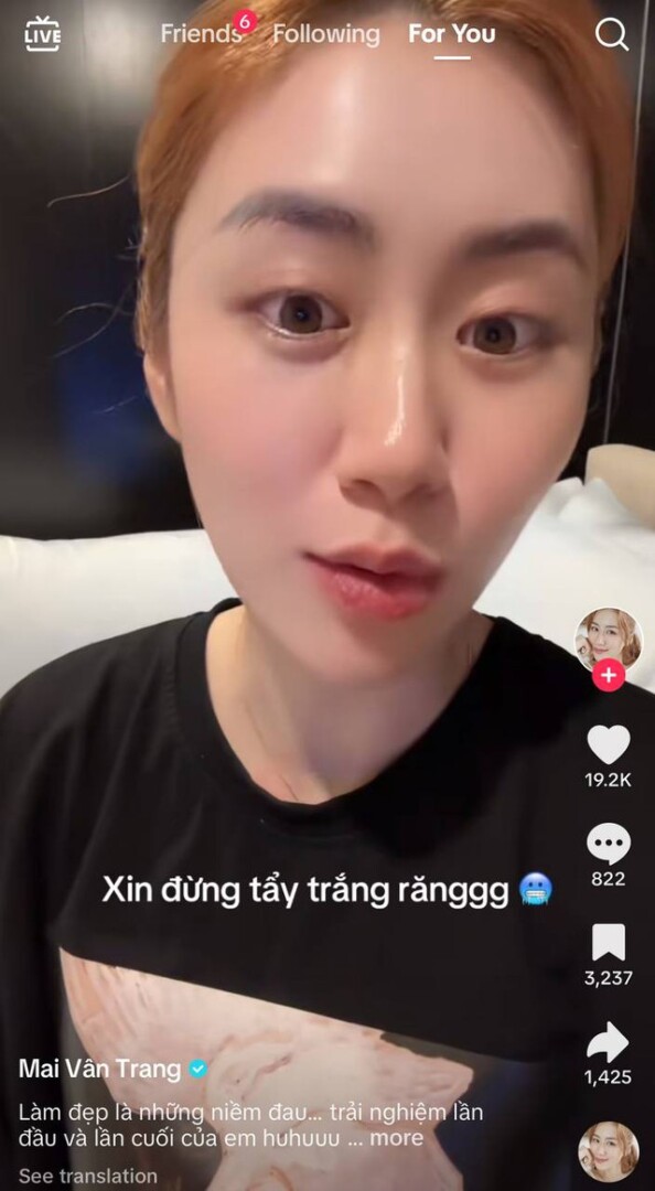 Tẩy răng