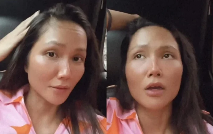 rụng tóc