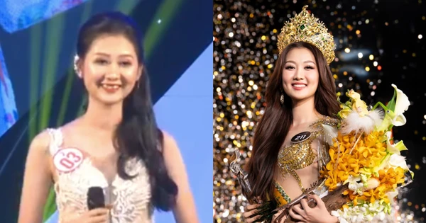 niềng răng