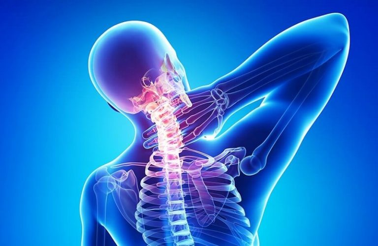 cổ vai gáy