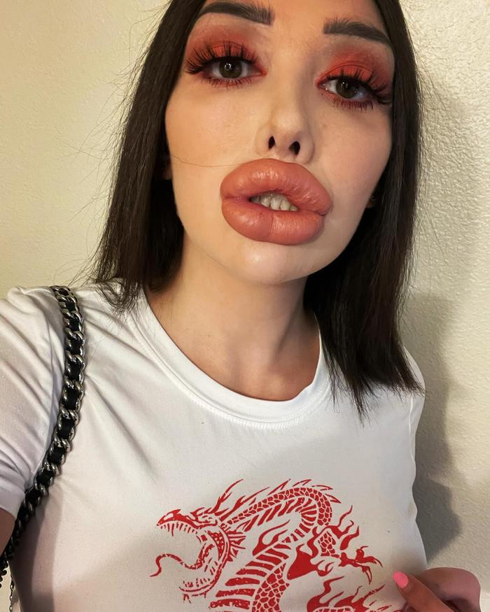 môi