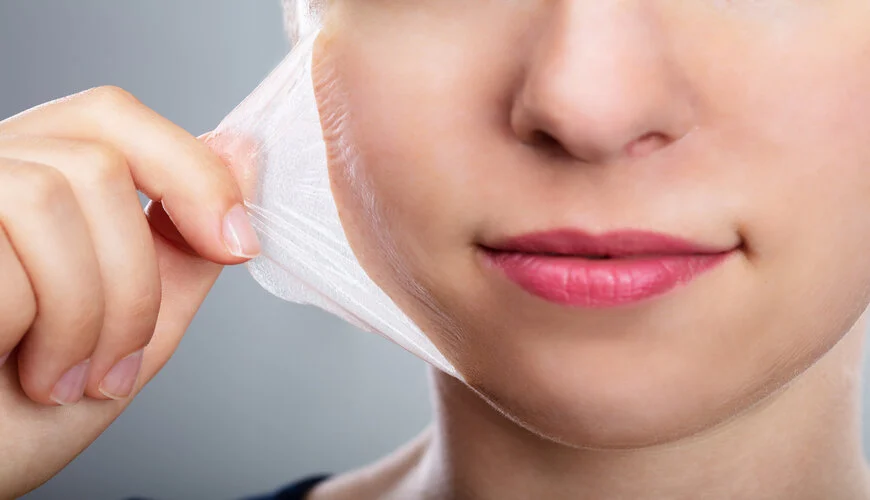 peel 